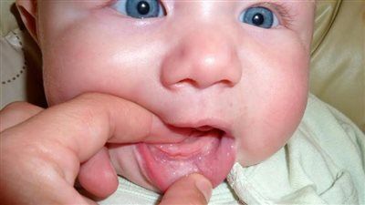 6 نصائح تساعد على تخفيف ألم التسنين عند الأطفال 