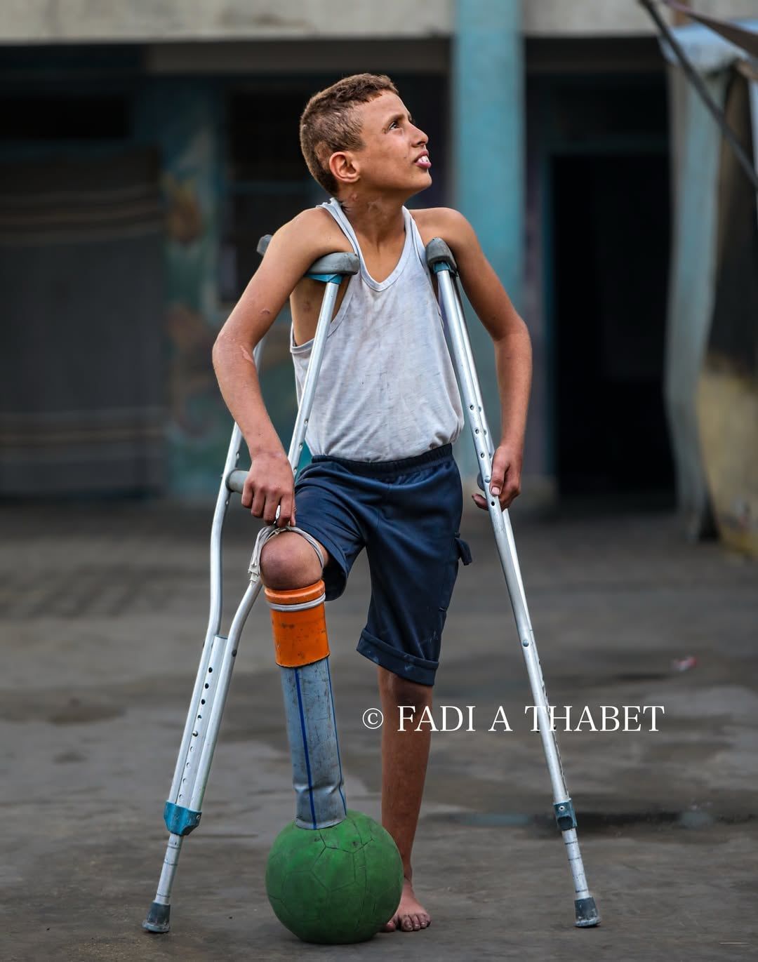 الإصابة لم تمنعه من اللعب