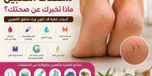 7 رسائل صحية يكشفها تشقق الكعبين لا تتجاهليها