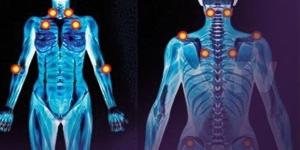 10 نصائح تساعد فى علاج مرض الفايبروميالجيا
