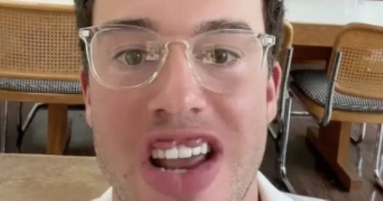 كندى يكتشف إصابته بحالة نادرة يسبب تعليقات الآخرين على صورته.. ما القصة