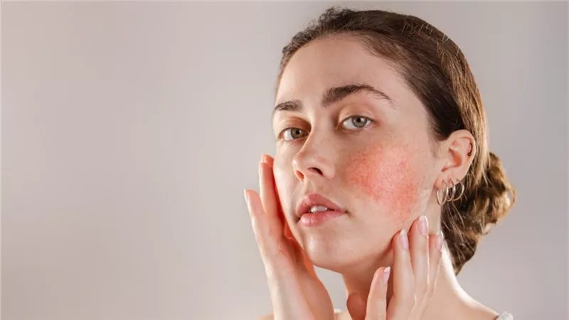 أفضل أعشاب طبيعية للعناية بالبشرة الحساسة في الخريف