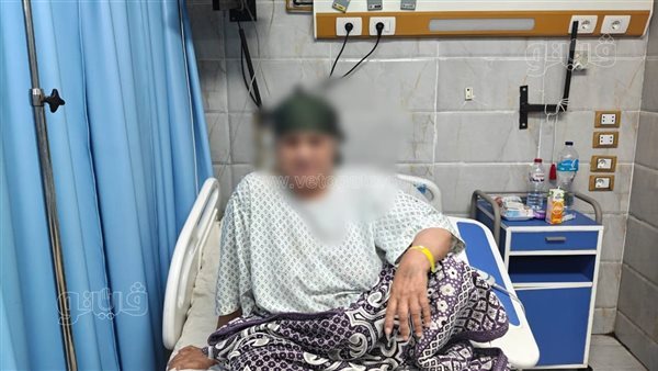 من لدغة في كعب القدم إلى التعافي، رحلة سيدة في مواجهة سم الثعبان بالشرقية (صور)