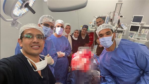 قرب شرايين المخ الرئيسية، أطباء طوارئ قصر العينى يستخرجون مسمارا من عظام جمجمة مريض