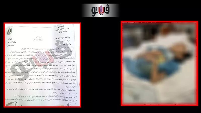دخل المستشفى لإزالة اللوزتين وخرج بشلل رباعي.. تفاصيل مأساة طفل الإسكندرية (مستند)