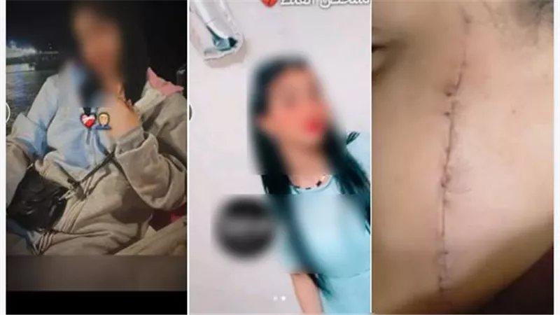 خلاف بين طالبتين ينتهي بإصابة إحداهما بجرح قطعي في الوجه أمام مدرسة بالإسكندرية