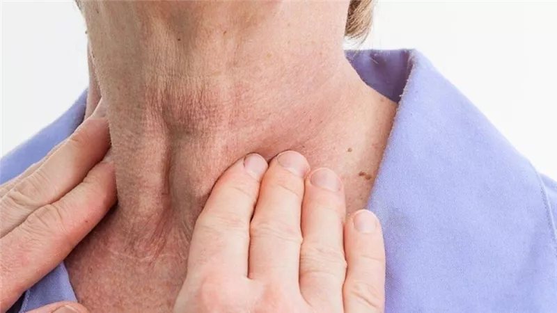 لا تهمليها، أعراض اضطراب الغدة الدرقية لدى النساء